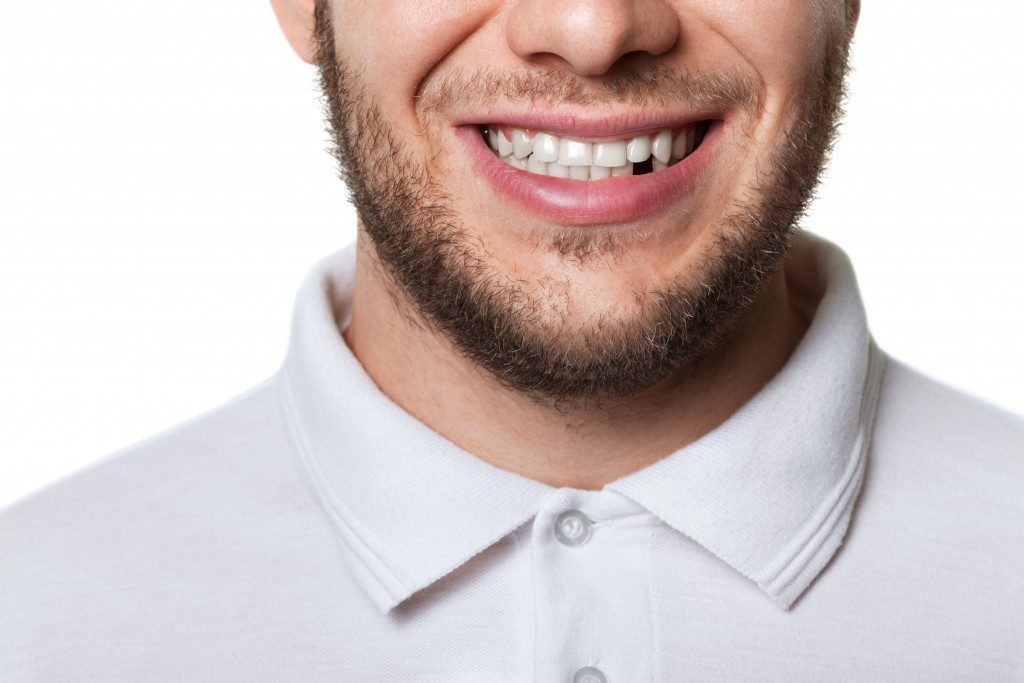 man with a missing tooth