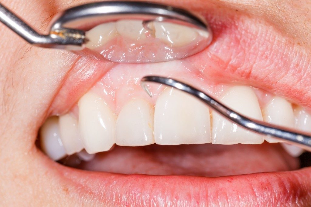 Close up of healthy gums