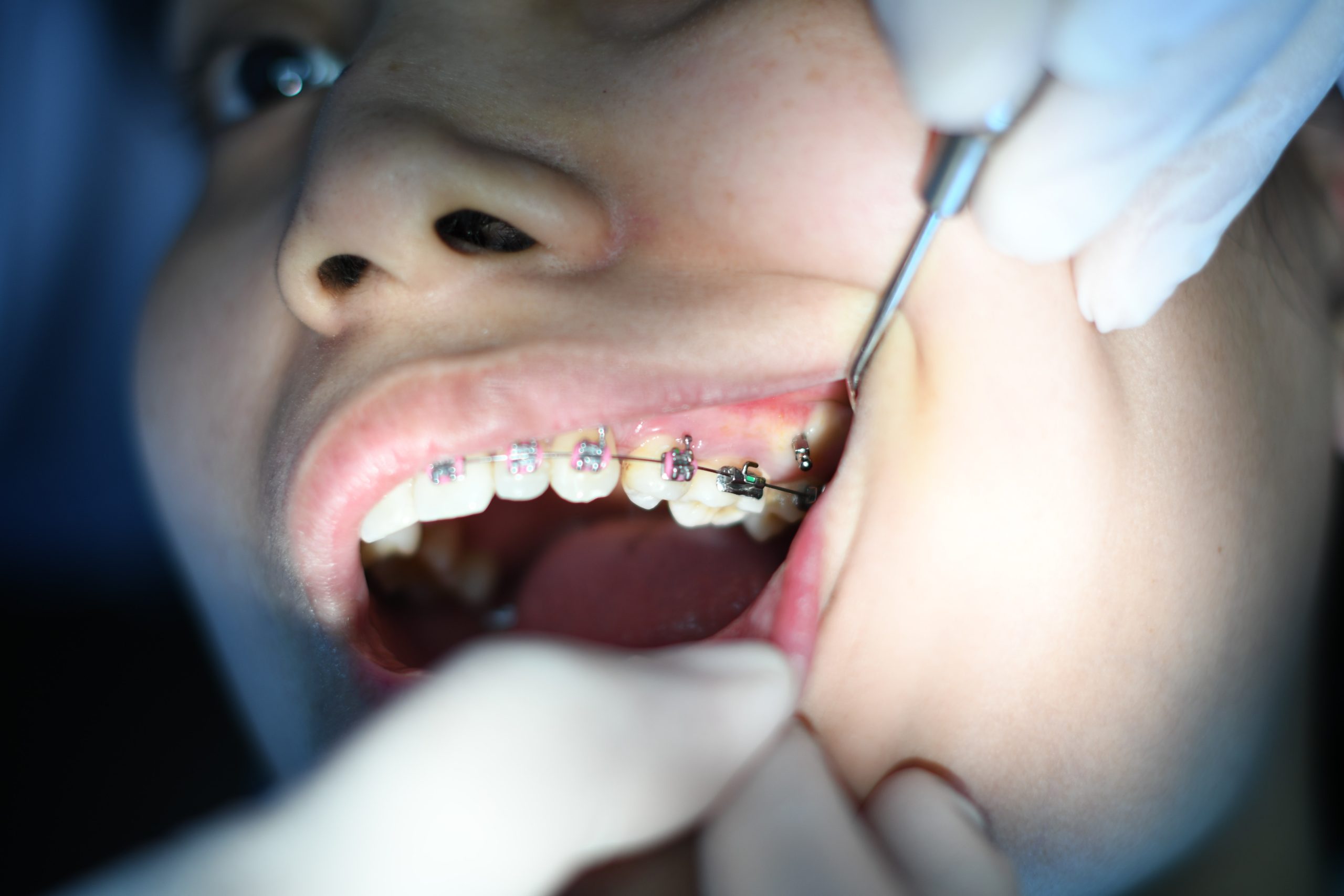dentist braces